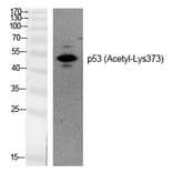 Western blot - p53 (Acetyl-Lys373) Polyclonal Antibody from Signalway Antibody (HW132) - Antibodies.com