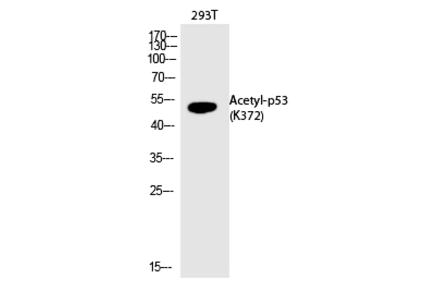 Western blot - p53 (Acetyl-Lys372) Polyclonal Antibody from Signalway Antibody (HW124) - Antibodies.com