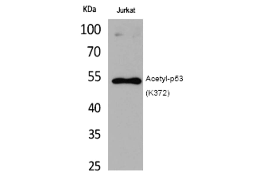 Western blot - p53 (Acetyl-Lys372) Polyclonal Antibody from Signalway Antibody (HW124) - Antibodies.com