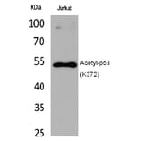 Western blot - p53 (Acetyl-Lys372) Polyclonal Antibody from Signalway Antibody (HW124) - Antibodies.com