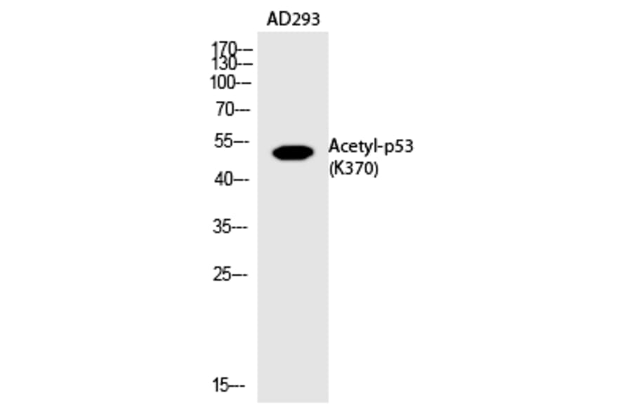Western blot - p53 (Acetyl-Lys370) Polyclonal Antibody from Signalway Antibody (HW123) - Antibodies.com