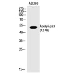 Western blot - p53 (Acetyl-Lys370) Polyclonal Antibody from Signalway Antibody (HW123) - Antibodies.com