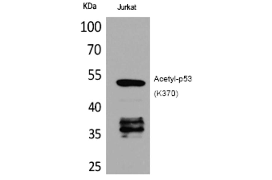 Western blot - p53 (Acetyl-Lys370) Polyclonal Antibody from Signalway Antibody (HW123) - Antibodies.com