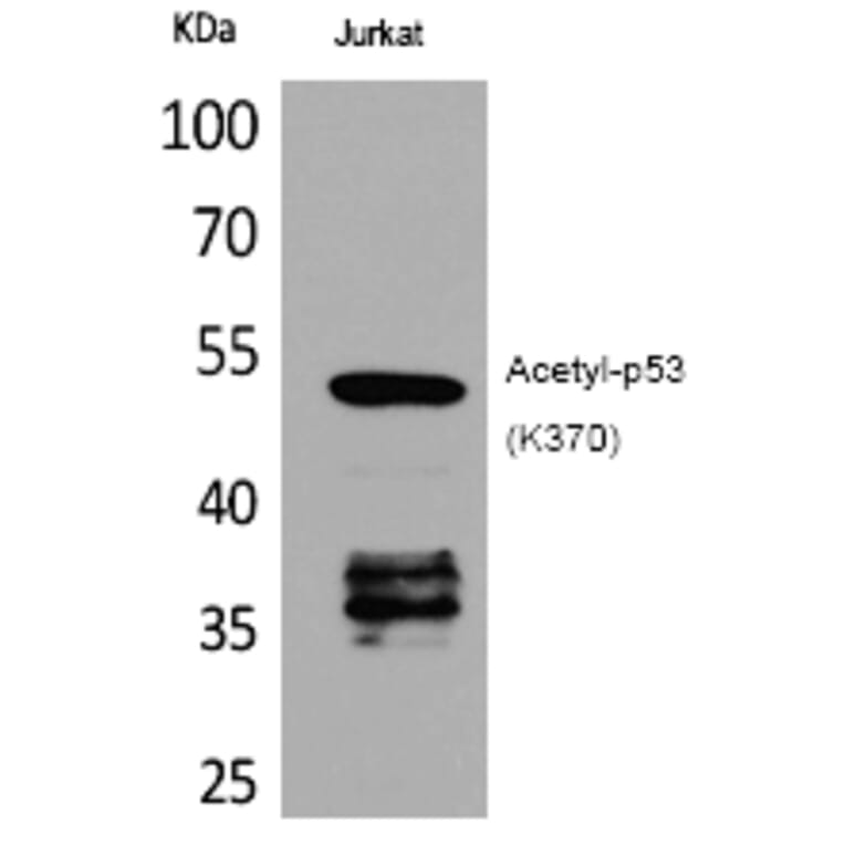 Western blot - p53 (Acetyl-Lys370) Polyclonal Antibody from Signalway Antibody (HW123) - Antibodies.com