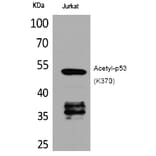 Western blot - p53 (Acetyl-Lys370) Polyclonal Antibody from Signalway Antibody (HW123) - Antibodies.com