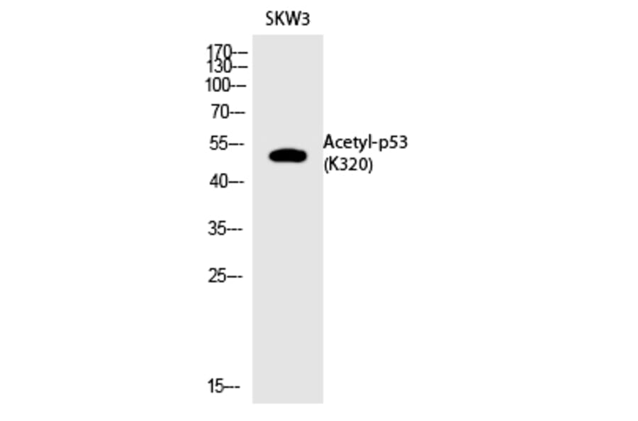 Western blot - p53 (Acetyl-Lys320) Polyclonal Antibody from Signalway Antibody (HW137) - Antibodies.com