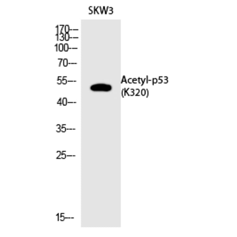Western blot - p53 (Acetyl-Lys320) Polyclonal Antibody from Signalway Antibody (HW137) - Antibodies.com