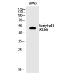 Western blot - p53 (Acetyl-Lys320) Polyclonal Antibody from Signalway Antibody (HW137) - Antibodies.com