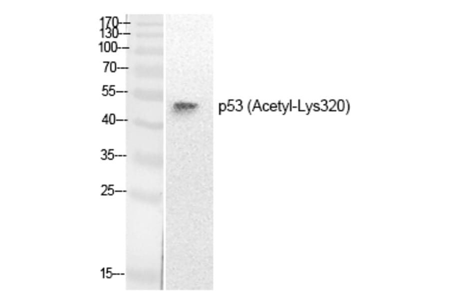 Western blot - p53 (Acetyl-Lys320) Polyclonal Antibody from Signalway Antibody (HW137) - Antibodies.com