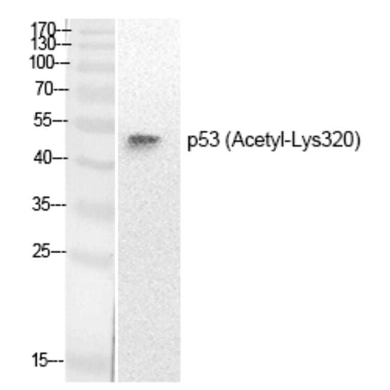Western blot - p53 (Acetyl-Lys320) Polyclonal Antibody from Signalway Antibody (HW137) - Antibodies.com