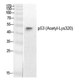 Western blot - p53 (Acetyl-Lys320) Polyclonal Antibody from Signalway Antibody (HW137) - Antibodies.com