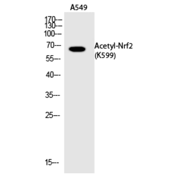 Western blot - Nrf2 (Acetyl-Lys599) Polyclonal Antibody from Signalway Antibody (HW147) - Antibodies.com