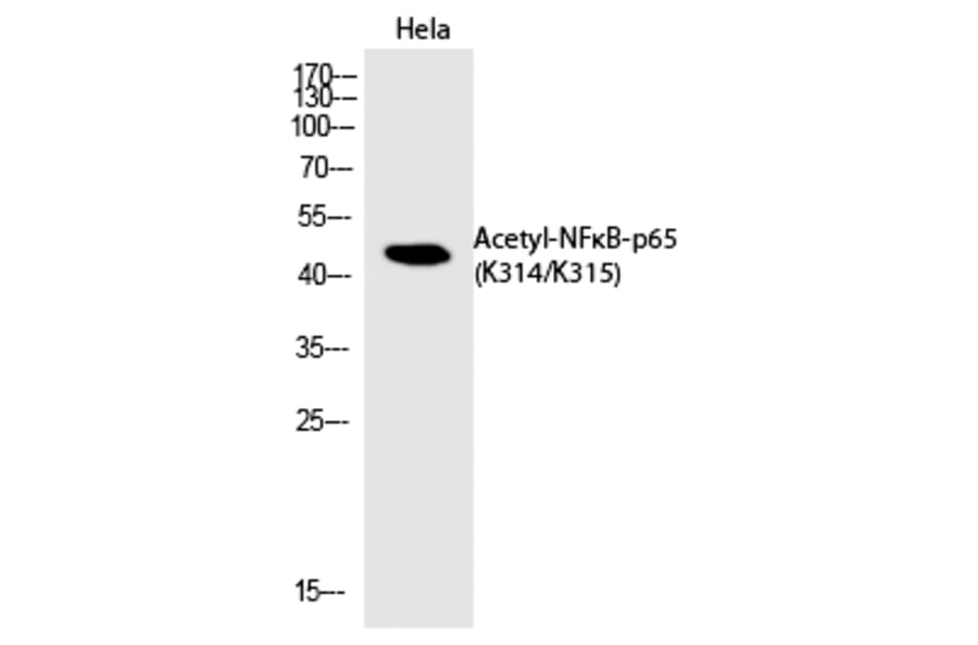 Western blot - NFκB-p65 (Acetyl-Lys314/Lys315) Polyclonal Antibody from Signalway Antibody - Antibodies.com
