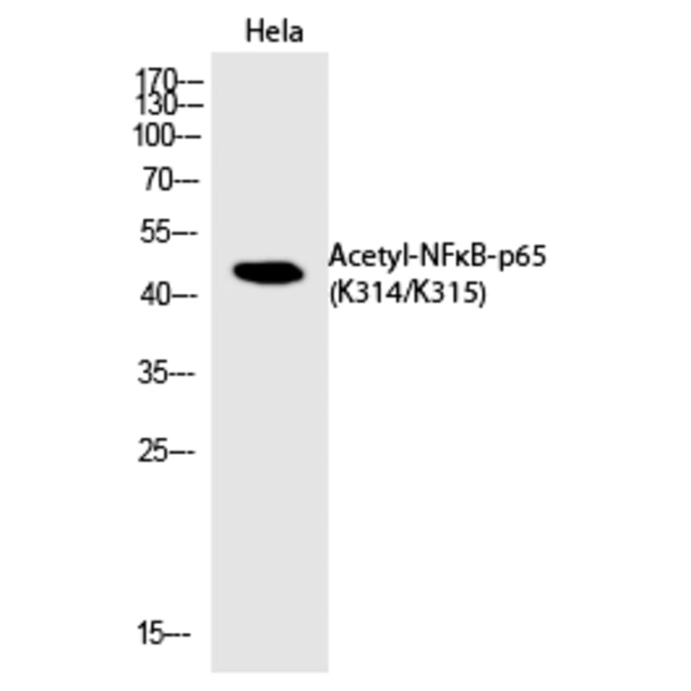 Western blot - NFκB-p65 (Acetyl-Lys314/Lys315) Polyclonal Antibody from Signalway Antibody - Antibodies.com