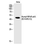 Western blot - NFκB-p65 (Acetyl-Lys314/Lys315) Polyclonal Antibody from Signalway Antibody - Antibodies.com