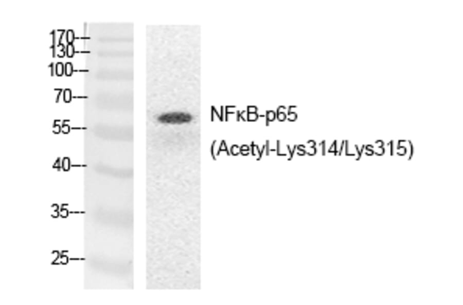 Western blot - NFκB-p65 (Acetyl-Lys314/Lys315) Polyclonal Antibody from Signalway Antibody - Antibodies.com