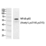Western blot - NFκB-p65 (Acetyl-Lys314/Lys315) Polyclonal Antibody from Signalway Antibody - Antibodies.com