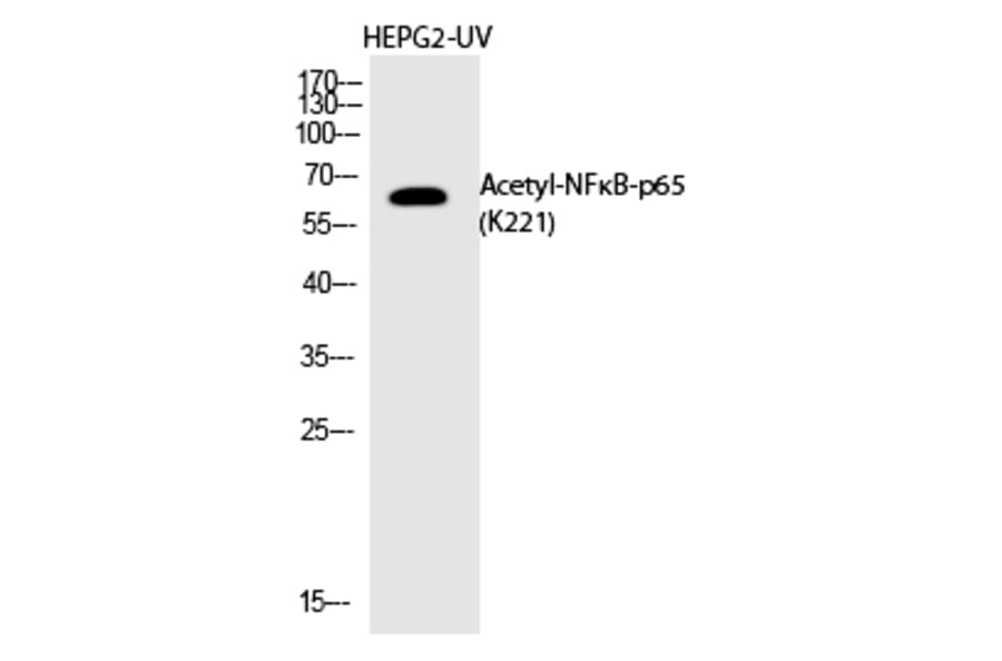 Western blot - NFκB-p65 (Acetyl-Lys221) Polyclonal Antibody from Signalway Antibody (HW149) - Antibodies.com