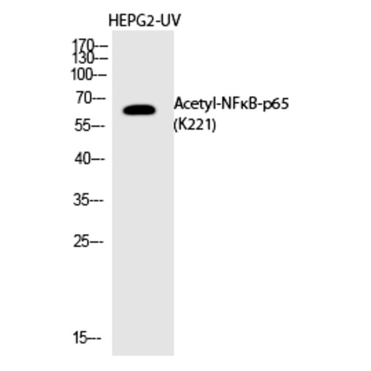 Western blot - NFκB-p65 (Acetyl-Lys221) Polyclonal Antibody from Signalway Antibody (HW149) - Antibodies.com