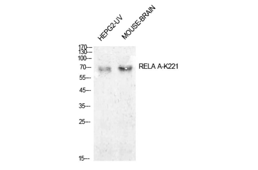 Western blot - NFκB-p65 (Acetyl-Lys221) Polyclonal Antibody from Signalway Antibody (HW149) - Antibodies.com