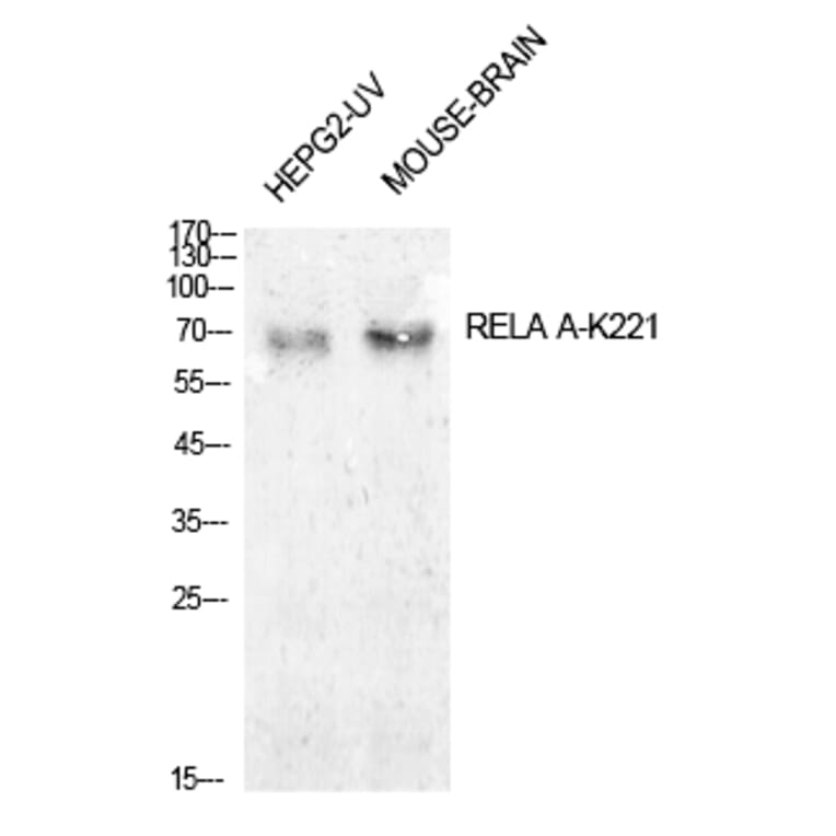 Western blot - NFκB-p65 (Acetyl-Lys221) Polyclonal Antibody from Signalway Antibody (HW149) - Antibodies.com