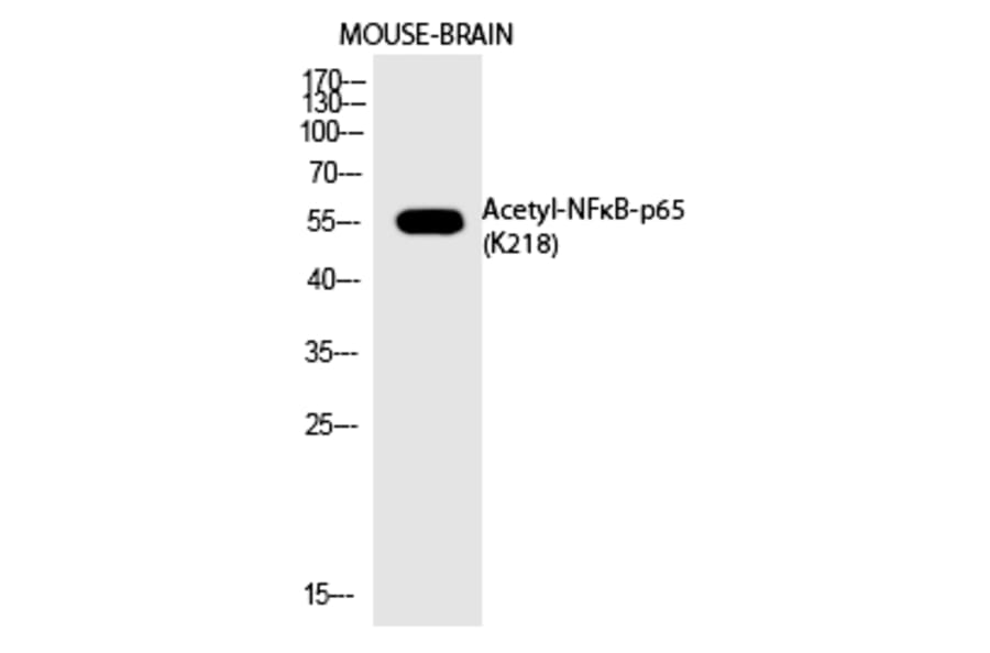 Western blot - NFκB-p65 (Acetyl-Lys218) Polyclonal Antibody from Signalway Antibody (HW122) - Antibodies.com