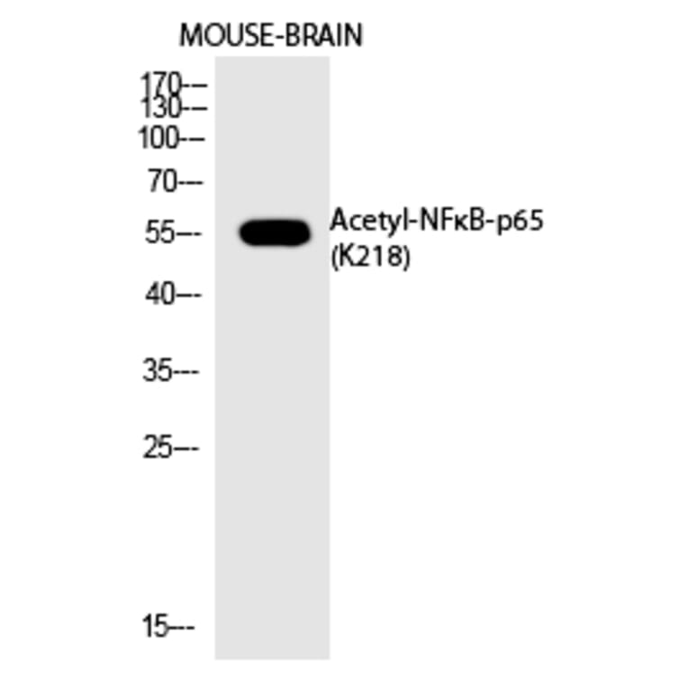 Western blot - NFκB-p65 (Acetyl-Lys218) Polyclonal Antibody from Signalway Antibody (HW122) - Antibodies.com