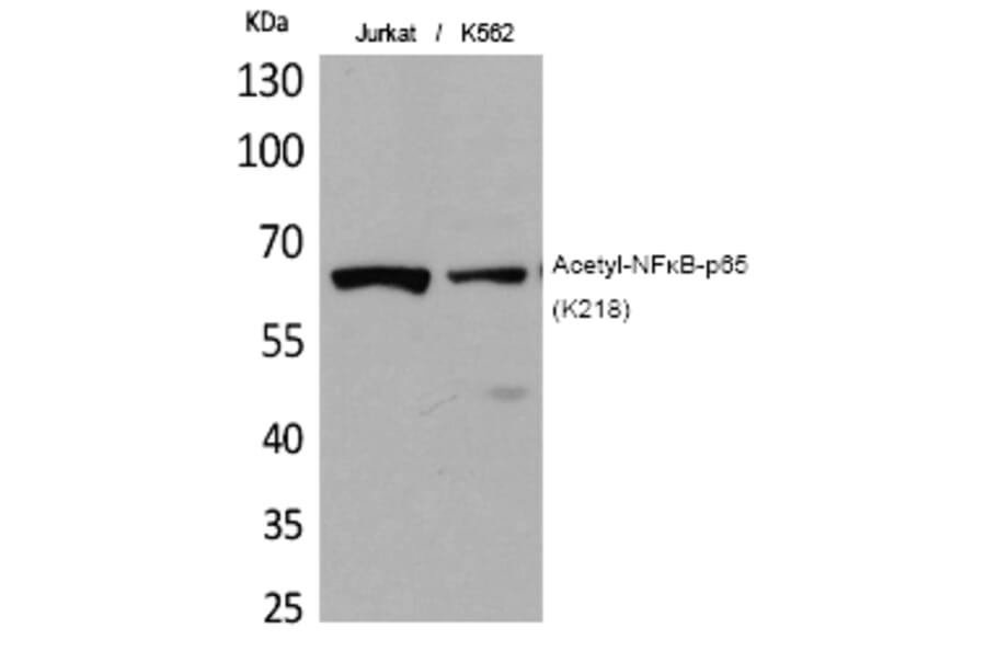 Western blot - NFκB-p65 (Acetyl-Lys218) Polyclonal Antibody from Signalway Antibody (HW122) - Antibodies.com