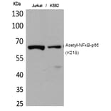 Western blot - NFκB-p65 (Acetyl-Lys218) Polyclonal Antibody from Signalway Antibody (HW122) - Antibodies.com