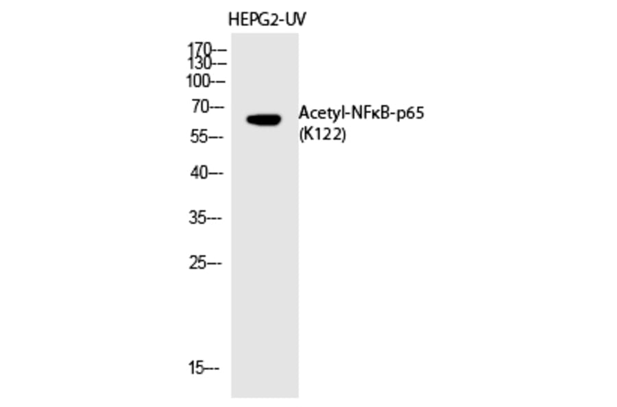 Western blot - NFκB-p65 (Acetyl-Lys122) Polyclonal Antibody from Signalway Antibody (HW148) - Antibodies.com