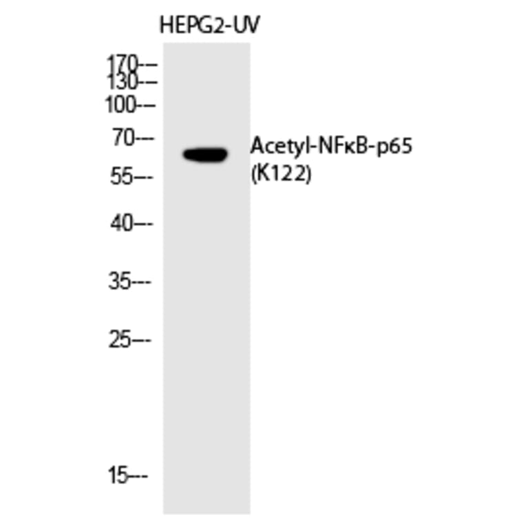 Western blot - NFκB-p65 (Acetyl-Lys122) Polyclonal Antibody from Signalway Antibody (HW148) - Antibodies.com
