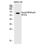 Western blot - NFκB-p65 (Acetyl-Lys122) Polyclonal Antibody from Signalway Antibody (HW148) - Antibodies.com