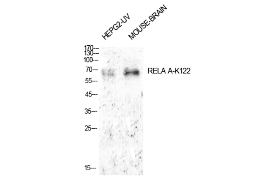 Western blot - NFκB-p65 (Acetyl-Lys122) Polyclonal Antibody from Signalway Antibody (HW148) - Antibodies.com