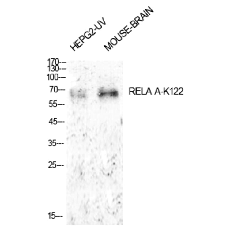 Western blot - NFκB-p65 (Acetyl-Lys122) Polyclonal Antibody from Signalway Antibody (HW148) - Antibodies.com