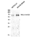 Western blot - NFκB-p65 (Acetyl-Lys122) Polyclonal Antibody from Signalway Antibody (HW148) - Antibodies.com