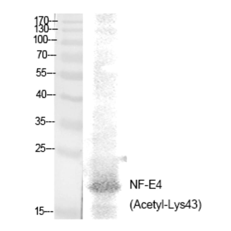Western blot - NF-E4 (Acetyl-Lys43) Polyclonal Antibody from Signalway Antibody (HW135) - Antibodies.com
