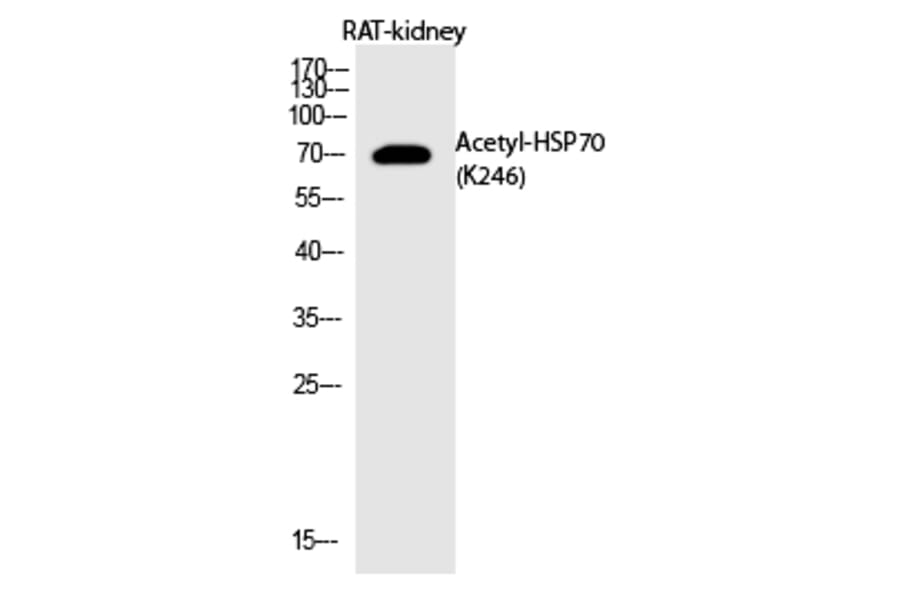 Western blot - HSP70 (Acetyl-Lys246) Polyclonal Antibody from Signalway Antibody (HW145) - Antibodies.com