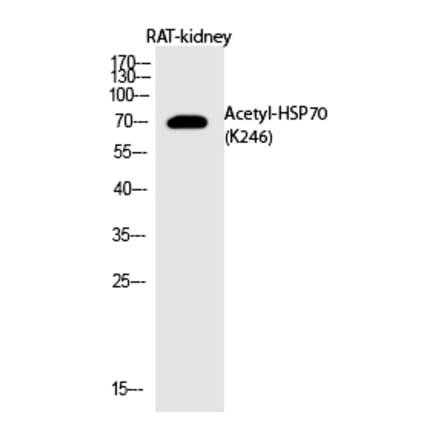 Western blot - HSP70 (Acetyl-Lys246) Polyclonal Antibody from Signalway Antibody (HW145) - Antibodies.com