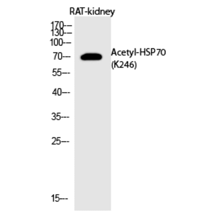 Western blot - HSP70 (Acetyl-Lys246) Polyclonal Antibody from Signalway Antibody (HW145) - Antibodies.com