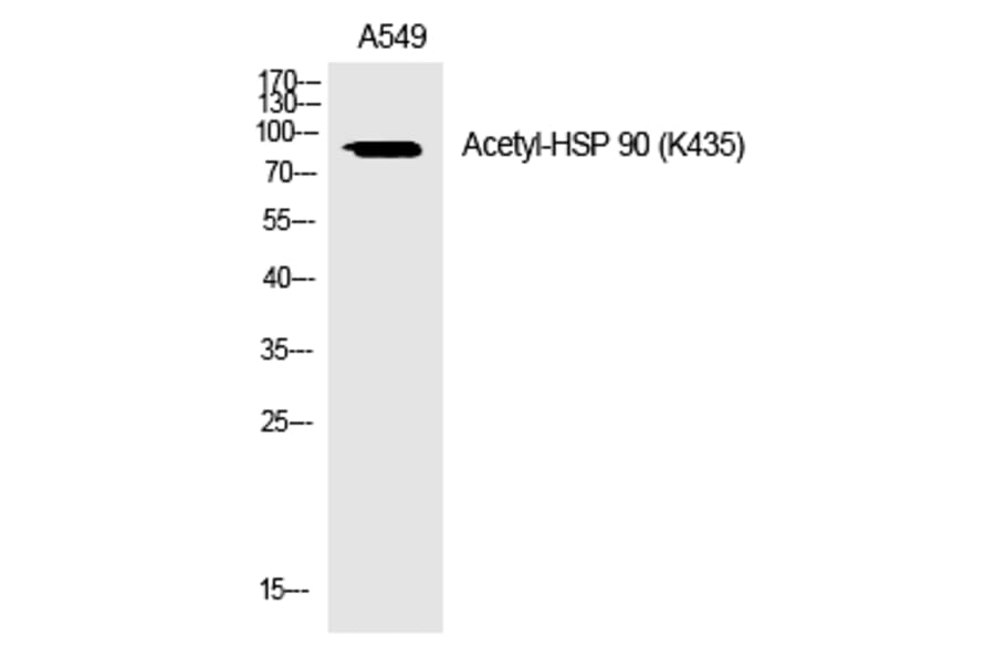 Western blot - HSP 90 (Acetyl-Lys435) Polyclonal Antibody from Signalway Antibody (HW119) - Antibodies.com