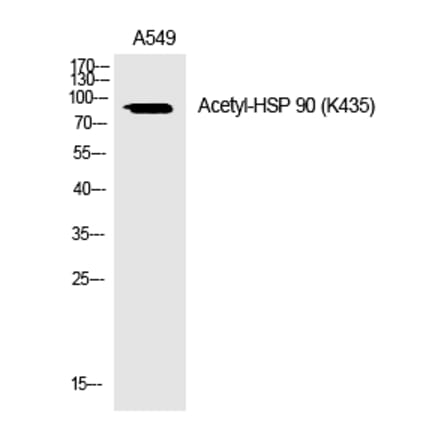 Western blot - HSP 90 (Acetyl-Lys435) Polyclonal Antibody from Signalway Antibody (HW119) - Antibodies.com