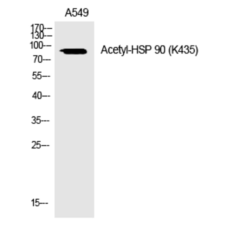 Western blot - HSP 90 (Acetyl-Lys435) Polyclonal Antibody from Signalway Antibody (HW119) - Antibodies.com