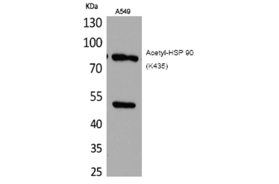 Western blot - HSP 90 (Acetyl-Lys435) Polyclonal Antibody from Signalway Antibody (HW119) - Antibodies.com