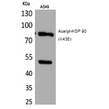 Western blot - HSP 90 (Acetyl-Lys435) Polyclonal Antibody from Signalway Antibody (HW119) - Antibodies.com