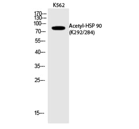 Western blot - HSP 90 (Acetyl-Lys292/284) Polyclonal Antibody from Signalway Antibody (HW118) - Antibodies.com