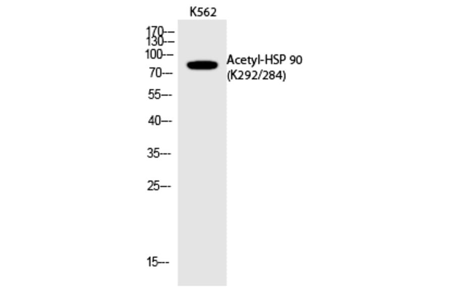 Western blot - HSP 90 (Acetyl-Lys292/284) Polyclonal Antibody from Signalway Antibody (HW118) - Antibodies.com