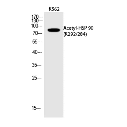 Western blot - HSP 90 (Acetyl-Lys292/284) Polyclonal Antibody from Signalway Antibody (HW118) - Antibodies.com
