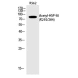 Western blot - HSP 90 (Acetyl-Lys292/284) Polyclonal Antibody from Signalway Antibody (HW118) - Antibodies.com