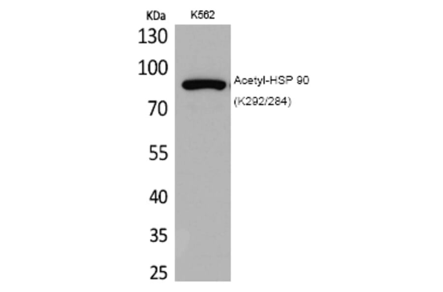 Western blot - HSP 90 (Acetyl-Lys292/284) Polyclonal Antibody from Signalway Antibody (HW118) - Antibodies.com