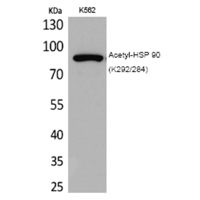 Western blot - HSP 90 (Acetyl-Lys292/284) Polyclonal Antibody from Signalway Antibody (HW118) - Antibodies.com